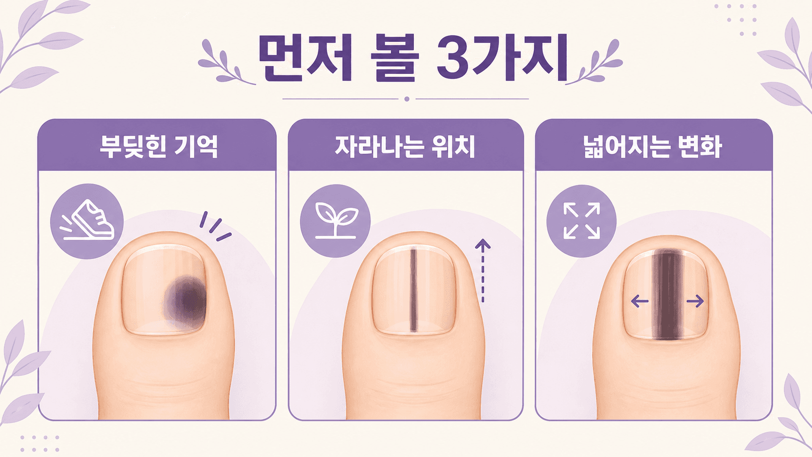 발톱 검은 줄을 볼 때 부딪힌 기억, 자라나는 위치, 넓어지는 변화를 나눠 보는 3분 체크 이미지