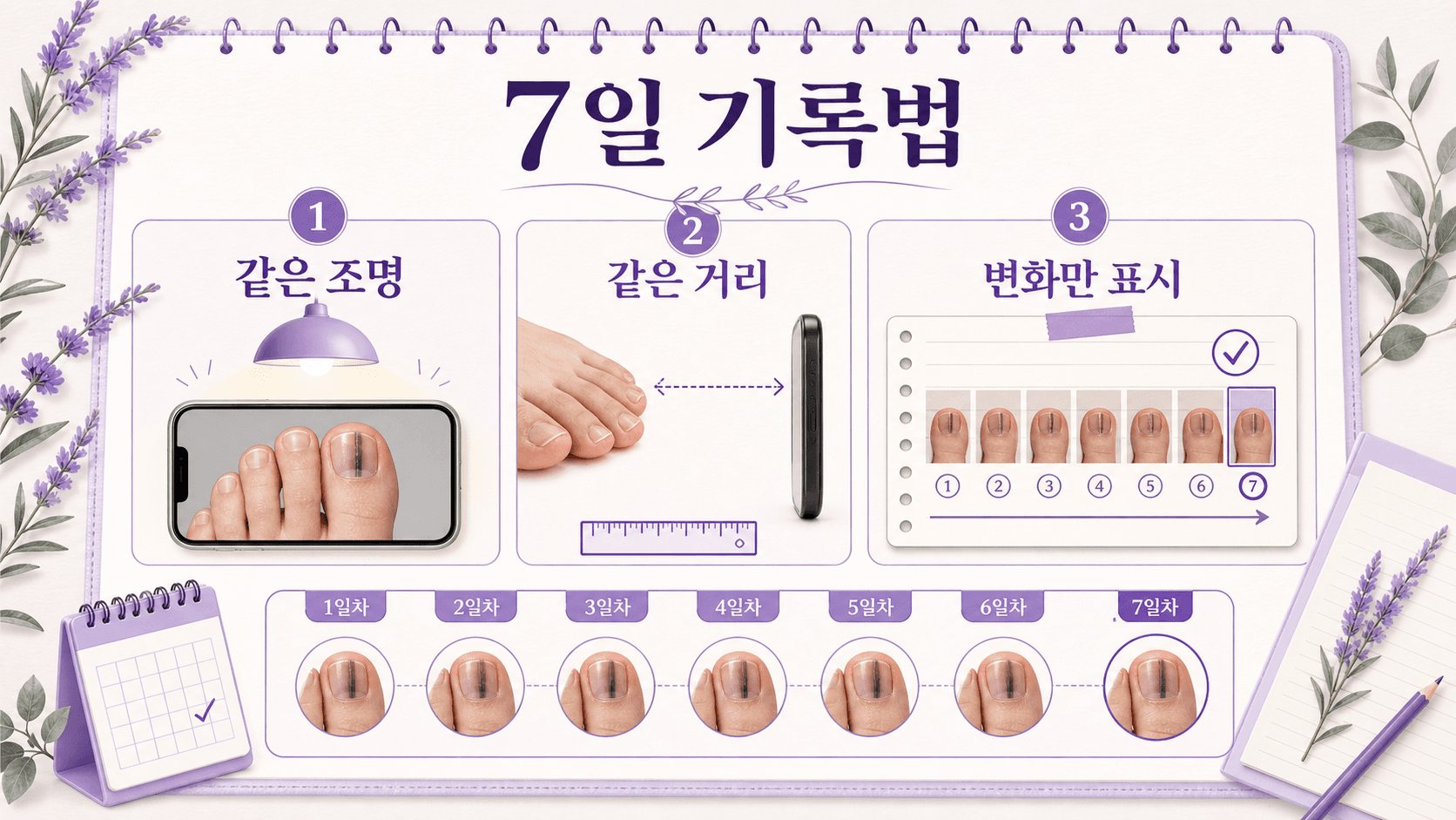 발톱 검은 줄을 같은 조명, 같은 거리, 변화 표시로 남기는 7일 기록법 이미지