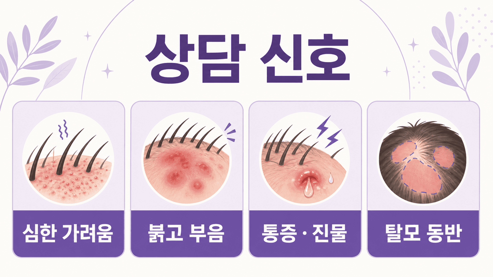두피 가려움에서 심한 가려움, 붉고 부음, 통증과 진물, 탈모 동반을 상담 신호로 보여주는 이미지