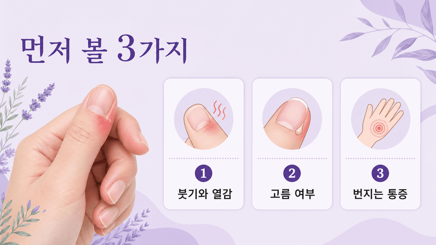 거스러미를 뜯은 뒤 손톱 옆 붓기에서 먼저 볼 3가지 기준 이미지