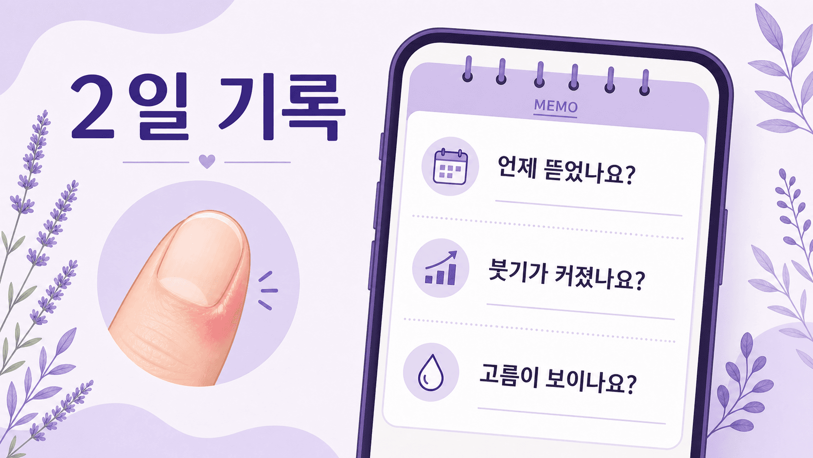 거스러미를 뜯은 뒤 손톱 옆 붓기를 2일 동안 기록하는 메모 이미지