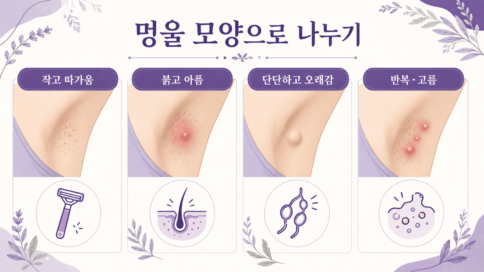 겨드랑이 멍울을 작고 따가움, 붉고 아픔, 단단하고 오래감, 반복·고름으로 나누는 이미지