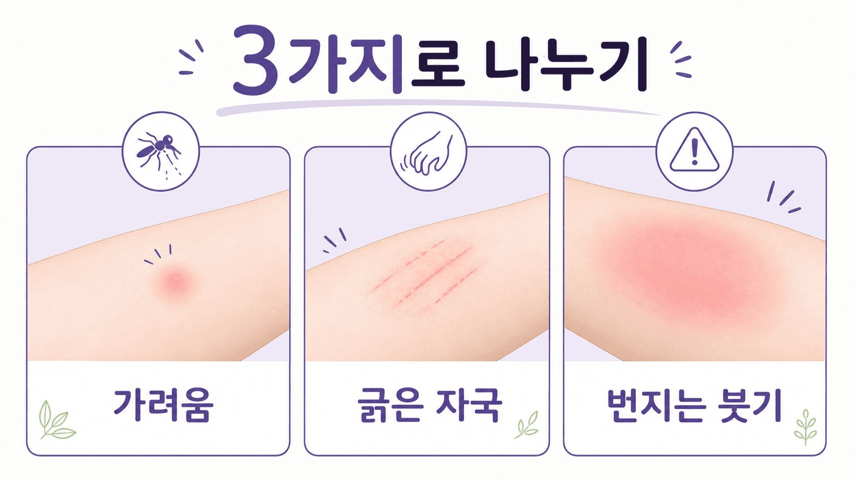 모기 물린 곳 붓기를 가려움, 긁은 자국, 번지는 붓기로 나누는 이미지