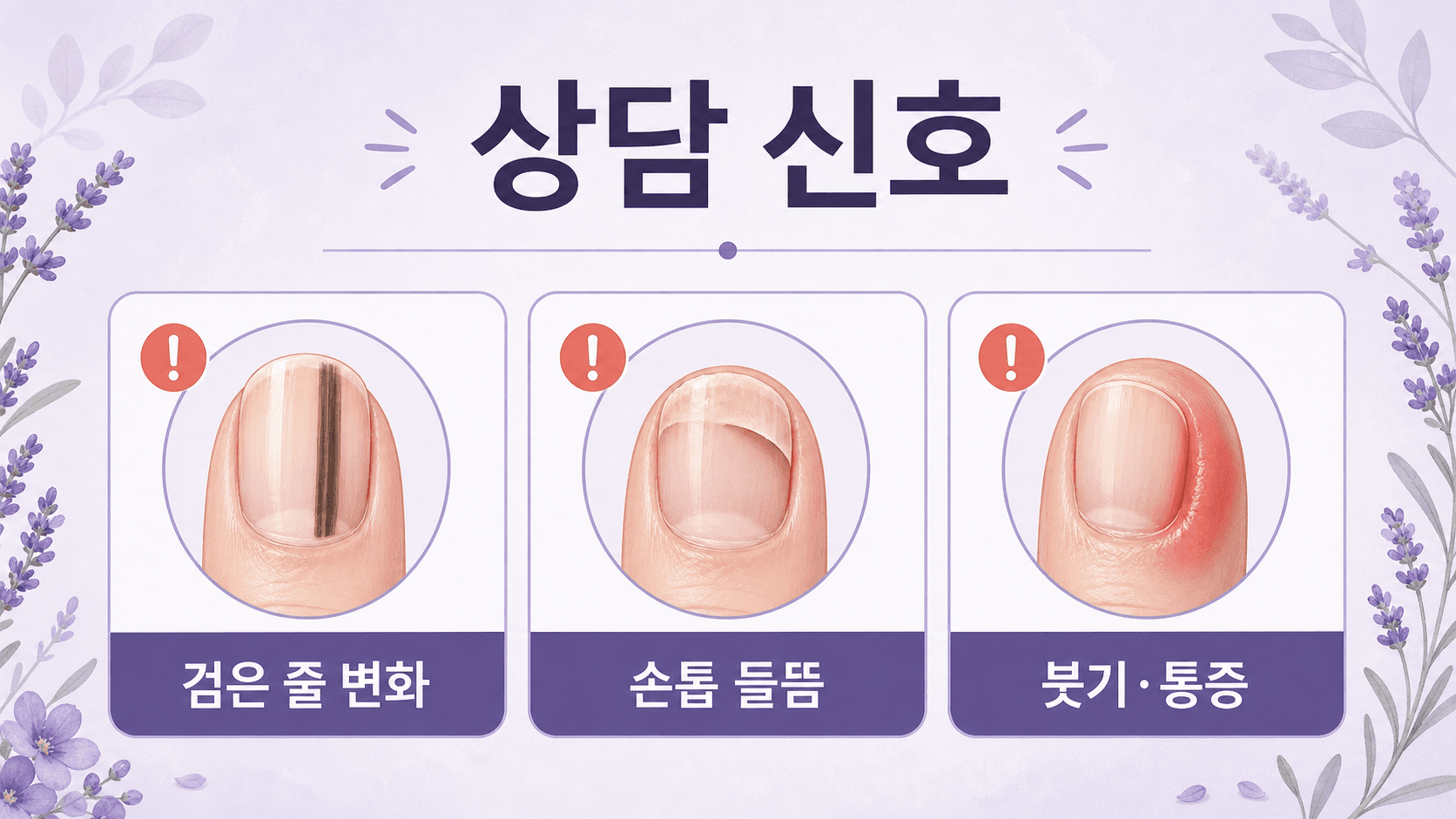손톱 검은 줄 변화, 손톱 들뜸, 붓기와 통증을 상담 신호로 정리한 이미지