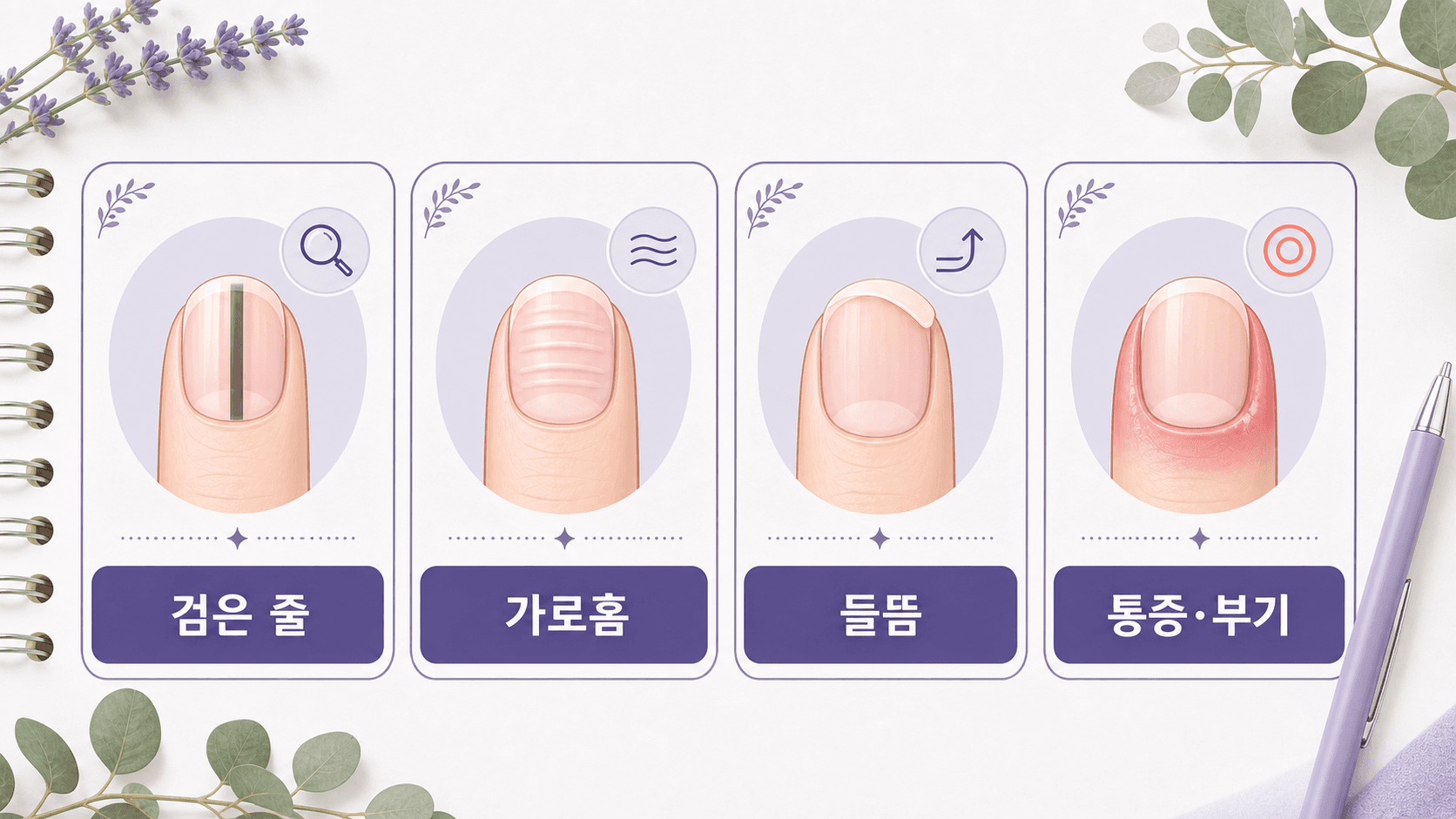 손톱 검은 줄, 가로홈, 들뜸, 통증과 부기를 상담 기준으로 보여주는 이미지