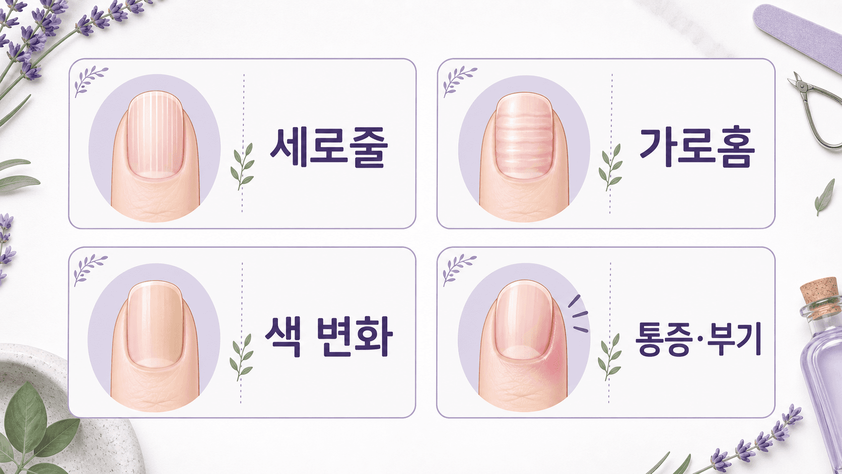 손톱 세로줄을 세로 결, 가로 홈, 색 변화, 통증과 부기로 나누는 4가지 기준 이미지