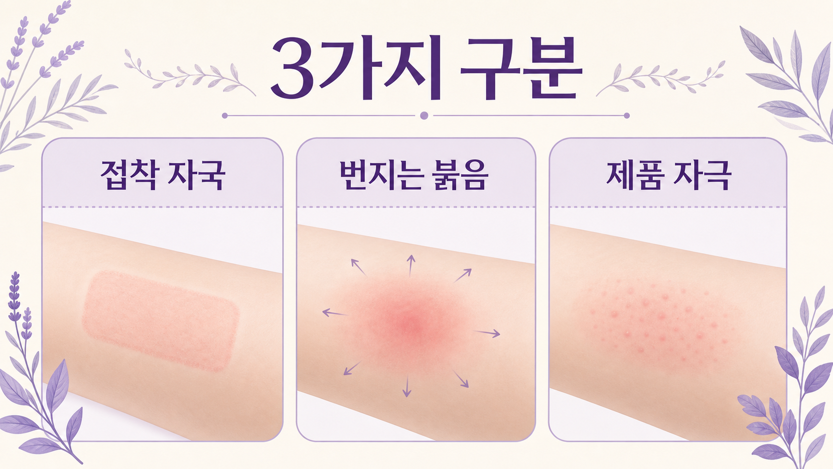 반창고 뗀 자리 빨개짐을 접착 자국, 번지는 붉음, 제품 자극으로 나누는 이미지