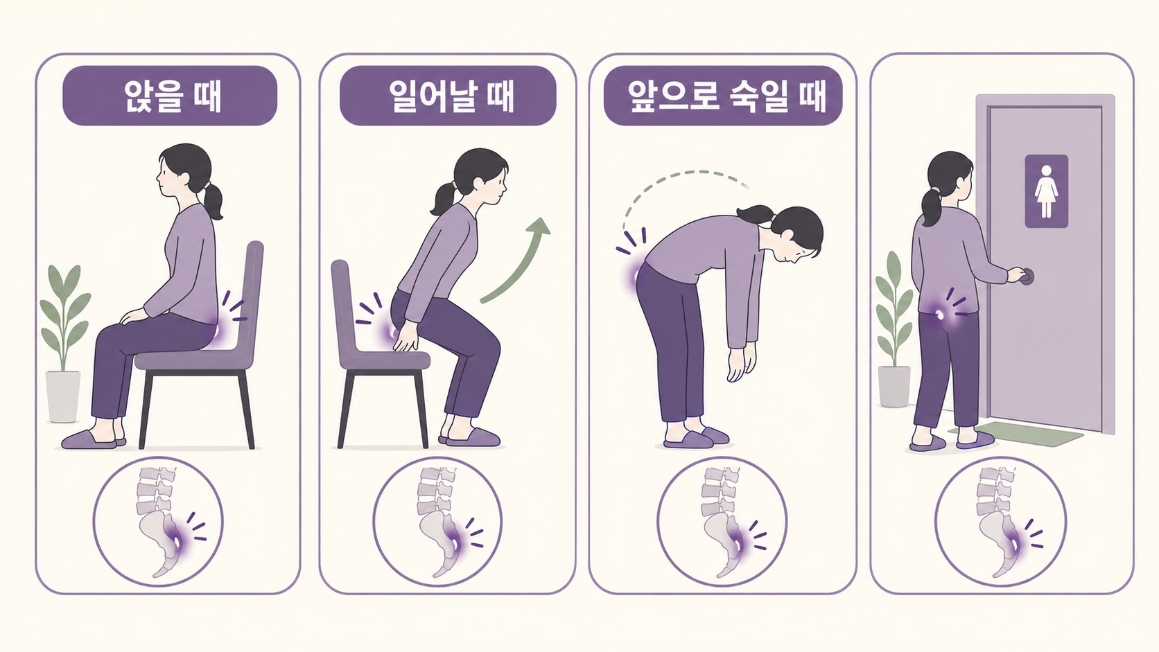 꼬리뼈 압박을 줄이기 위해 앉는 각도, 앞으로 살짝 기대기, 웨지 쿠션 위치를 10분 기준으로 보여주는 보라색 의학 인포그래픽
